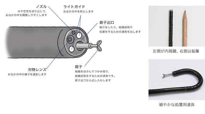 直径（5mm前後）最新の内視鏡システムを導入